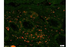 Formalin-fixed and paraffin-embedded rat brain labeled with Anti-MCT1 Polyclonal Antibody, Unconjugated (ABIN731468) 1:200, overnight at 4 °C, The secondary antibody was Goat Anti-Rabbit IgG, Cy3 conjugated used at 1:200 dilution for 40 minutes at 37 °C. (MCTS1 antibody  (C-Term))