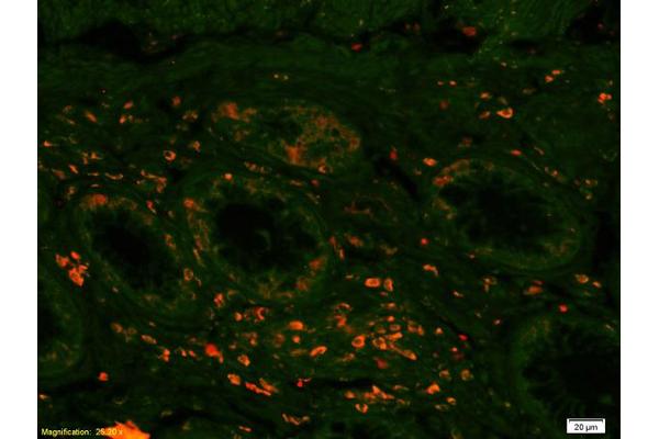 SLC16A1 antibody  (C-Term)