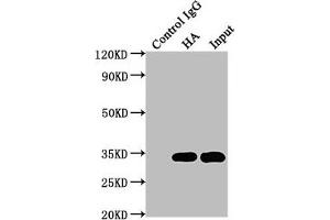 Immunoprecipitating HA-Tag in 293F transfected whole cell lysate Lane 1: Mouse control IgG (1 μg) instead of ABIN7193151 in 293F transfected whole cell lysate. (HA-Tag antibody)