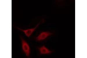 ABIN6274485 staining HeLa cells by IF/ICC. (SERINC2 antibody  (Internal Region))