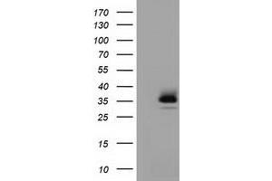 HEK293T cells were transfected with the pCMV6-ENTRY control (Left lane) or pCMV6-ENTRY RFPL1 (Right lane) cDNA for 48 hrs and lysed. (RFPL1 antibody)