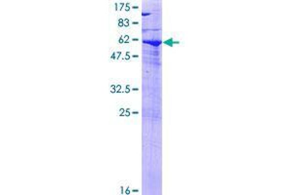 SPG21 Protein (AA 1-308) (GST tag)