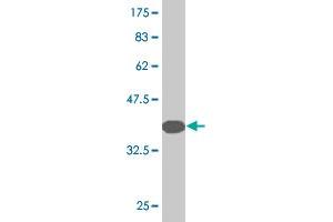 Western Blot detection against Immunogen (37. (GTF3C5 antibody  (AA 378-485))