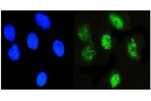 IF analysis of NFIA using anti-NFIA antibody (ABIN6719349). (NFIA antibody  (Middle Region))