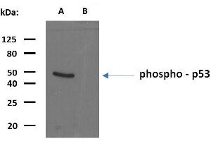 Western blotting analysis of phosphorylated human p53 using mouse monoclonal antibody FP3. (p53 antibody  (pSer392))