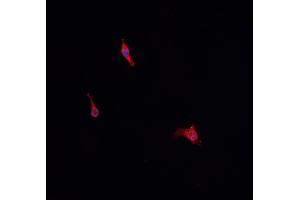 ABIN6276857 staining HepG2? (CD3 epsilon antibody  (C-Term))