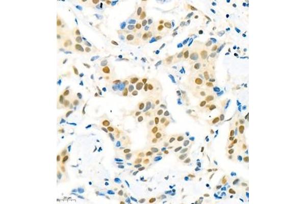 SUV39H2 antibody