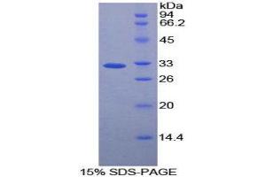SDS-PAGE (SDS) image for Caspase 12 (Gene/pseudogene) (CASP12) (AA 1-244) protein (His tag) (ABIN2124246)
