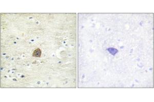 Immunohistochemical analysis of paraffin-embedded human brain tissue using CaMKII (Phospho-Thr305) antibody (left)or the same antibody preincubated with blocking peptide (right). (CAMK2A antibody  (pThr305))
