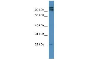 WB Suggested Anti-MRPL49 Antibody Titration: 0. (MRPL49 antibody  (N-Term))