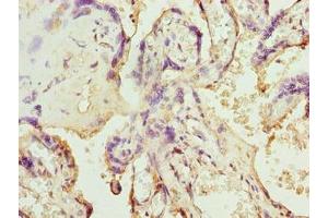 Immunohistochemistry of paraffin-embedded human placenta tissue using ABIN7170079 at dilution of 1:100 (SLC12A4 antibody  (AA 601-900))