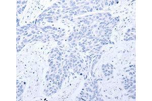 Immunohistochemistry (IHC) image for anti-Gastrin-Releasing Peptide Receptor (GRPR) antibody (ABIN1872904)