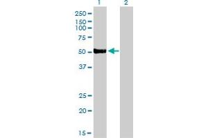 Western Blot analysis of FOXA2 expression in transfected 293T cell line by FOXA2 monoclonal antibody (M01), clone 7E6. (FOXA2 antibody  (AA 363-457))