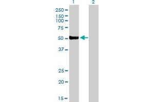 Western Blot analysis of FOXA2 expression in transfected 293T cell line by FOXA2 monoclonal antibody (M01), clone 7E6.