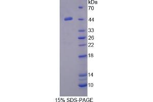 Image no. 1 for serpin Peptidase Inhibitor, Clade A (Alpha-1 Antiproteinase, Antitrypsin), Member 5 (SERPINA5) (AA 43-406) protein (His tag) (ABIN4989815)