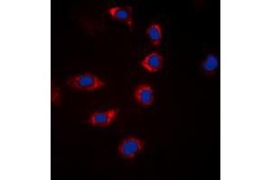 Immunofluorescent analysis of BAD (pS155) staining in Hela cells. (BAD antibody  (C-Term, pSer155))