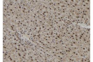 ABIN6273051 at 1/100 staining Mouse liver tissue by IHC-P. (Importin 4 antibody  (Internal Region))