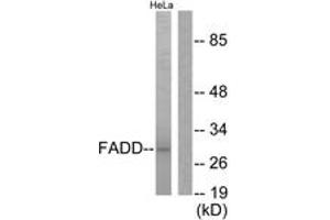 Western blot analysis of extracts from HeLa cells, treated with PMA 125ng/ml 30', using FADD (Ab-194) Antibody. (FADD antibody  (AA 159-208))