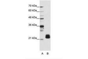 Image no. 2 for anti-Transmembrane Emp24 Protein Transport Domain Containing 4 (TMED4) (N-Term) antibody (ABIN202093) (TMED4 antibody  (N-Term))