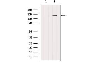 Western blot analysis of extracts from B16F10, using MN1 Antibody. (Meningioma 1 antibody  (Internal Region))