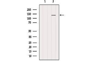 Western blot analysis of extracts from B16F10, using MN1 Antibody.