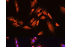 Immunofluorescence analysis of C6 cells using BTRC Polyclonal Antibody at dilution of 1:100. (BTRC antibody)