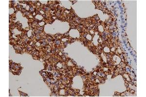 ABIN6267521 at 1/200 staining Mouse lung2. (ZAP70 antibody  (pTyr319))
