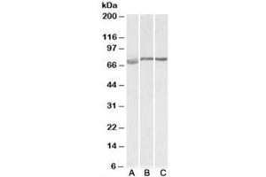 Western blot testing of human [A], mouse [B] and rat [C] testis lysate with DMTF1 antibody at 1ug/ml. (DMP1 antibody)
