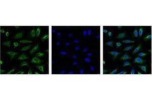 Immunofluorescence (IF) analysis of HeLa with antibody (Left) and DAPI (Right) diluted at 1:100. (Aquaporin 4 antibody)