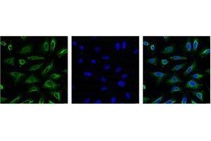 Immunofluorescence (IF) analysis of HeLa with antibody (Left) and DAPI (Right) diluted at 1:100. (Aquaporin 4 antibody)