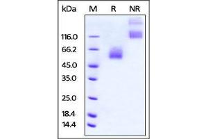 Rat CD47, Fc Tag on SDS-PAGE under reducing (R) and no-reducing (NR) conditions. (CD47 Protein (CD47) (AA 19-140) (Fc Tag))