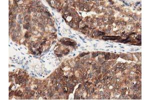 Immunohistochemistry (IHC) image for anti-DnaJ (Hsp40) Homolog, Subfamily A, Member 2 (DNAJA2) antibody (ABIN1497861) (DNAJA2 antibody)