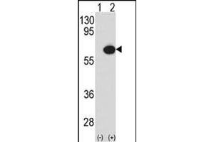 Western blot analysis of P3K7IP1 (arrow) using rabbit polyclonal P3K7IP1-p (ABIN390847 and ABIN2841073). (TAB1 antibody  (AA 416-445))
