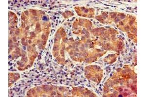 Immunohistochemistry (IHC) image for anti-Interferon-Induced Protein with Tetratricopeptide Repeats 1 (IFIT1) (AA 1-181) antibody (ABIN7156663)