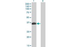 Western Blot analysis of ZNF187 expression in transfected 293T cell line by ZNF187 monoclonal antibody (M04), clone 3E11. (ZNF187 antibody  (AA 1-325))