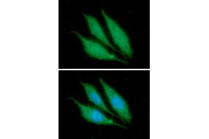 ICC/IF analysis of KRT14 in PC3 cells. (KRT14 antibody  (AA 1-472))
