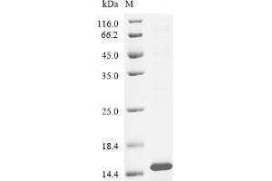 (Tris-Glycine gel) Discontinuous SDS-PAGE (reduced) with 5 % enrichment gel and 15 % separation gel.