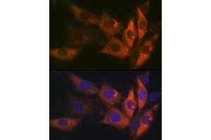 Immunofluorescence analysis of NIH-3T3 cells using AMPKβ1 Rabbit mAb (ABIN7269654) at dilution of 1:100 (40x lens). (PRKAB1 antibody)