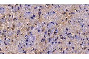 Immunohistochemistry (IHC) image for anti-Histone Deacetylase 6 (HDAC6) (AA 560-811) antibody (ABIN7439288)