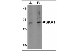 Western blot analysis of SKA1 in A549 cell lysate with SKA1 antibody at (A) 0.