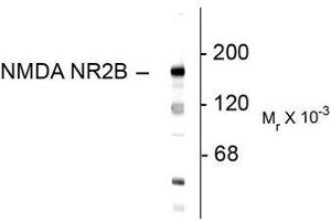 Image no. 1 for anti-Glutamate Receptor, Ionotropic, N-Methyl D-Aspartate 2B (GRIN2B) (N-Term) antibody (ABIN372684) (GRIN2B antibody  (N-Term))