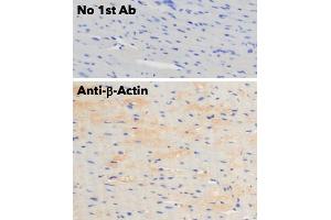 Immunohistochemistry (IHC) image for anti-Actin, beta (ACTB) (N-Term) antibody (ABIN6254200) (beta Actin antibody  (N-Term))