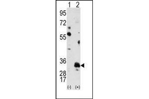 Image no. 2 for anti-Pim-1 Oncogene (PIM1) antibody (ABIN360328) (PIM1 antibody)