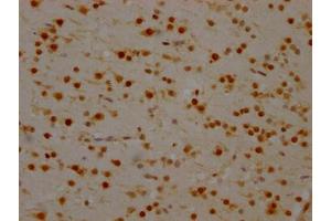 IHC image of ABIN7127546 diluted at 1:100 and staining in paraffin-embedded human brain tissue performed on a Leica BondTM system. (Recombinant SYNCRIP antibody)
