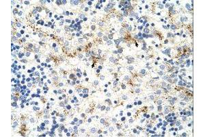 Image no. 1 for anti-Moloney Leukemia Virus 10 (MOV10) (C-Term) antibody (ABIN204954) (MOV10 antibody  (C-Term))