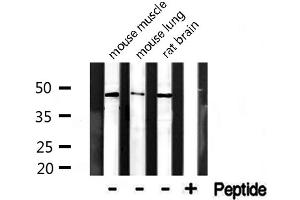 Western blot analysis of extracts from various tissue, using CADM4 antibody. (Cell Adhesion Molecule 4 antibody  (C-Term))