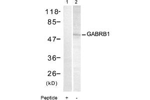 Image no. 1 for anti-gamma-aminobutyric Acid (GABA) A Receptor, Subunit beta 1 (GABRB1) (Ser434) antibody (ABIN319327) (GABRB1 antibody  (Ser434))