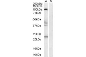 Image no. 1 for anti-Reticulon 4 Receptor (RTN4R) (Internal Region) antibody (ABIN374563) (RTN4R antibody  (Internal Region))