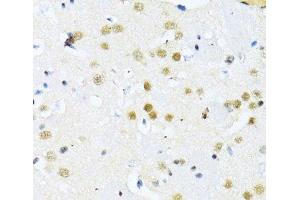 Immunohistochemistry of paraffin-embedded Mouse brain using ITGB3BP Polyclonal Antibody at dilution of 1:100 (40x lens). (ITGB3BP antibody)