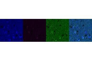 Immunohistochemistry (IHC) image for anti-Cannabinoid Receptor 1 (CNR1) antibody (ABIN7456307) (CNR1 antibody)